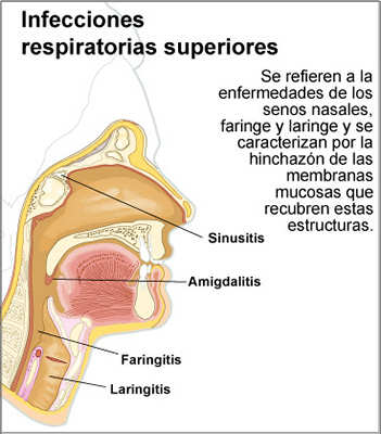 Infecciones respiratorias superiores