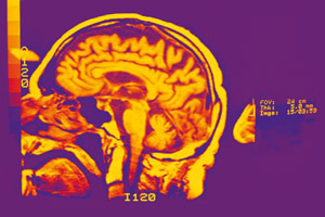 Disorders in the central nervous system