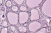 ¿Cuáles son las enfermedades del sistema endocrino?