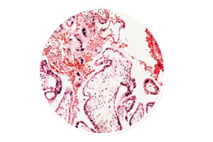 Saco amniótico, placenta y cordón umbilical