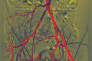 Vasos sanguíneos.jpg